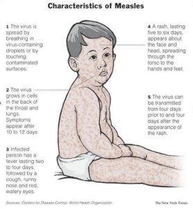 measles2