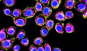 Bronchial-Epithelial-Cells_DAPI_Golgin97_MITO_Phal_60x_1